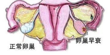 打干细胞真的可以修复卵巢早衰吗