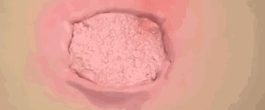 当干细胞进入你体内后的神奇表现