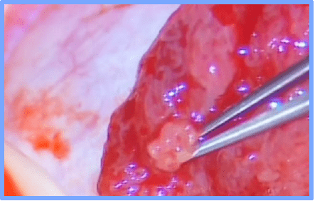 人造精子都出来了！无精子症也能生娃-北联世纪3D精子体外培养