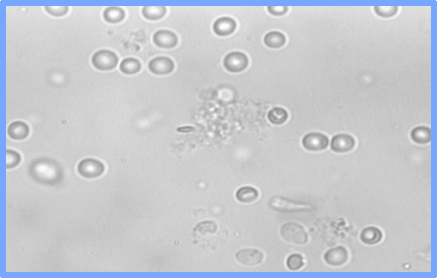 人造精子都出来了！无精子症也能生娃-北联世纪3D精子体外培养