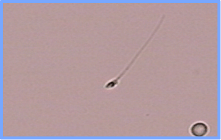 人造精子都出来了！无精子症也能生娃-北联世纪3D精子体外培养