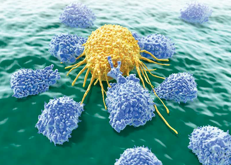 什么是NK-T细胞免疫疗法