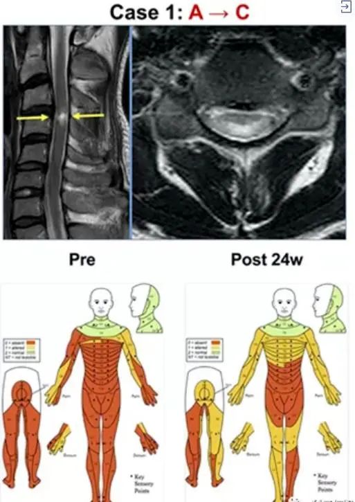 间充质干细胞治疗涉及130种适应症，足以应对各大系统疾病！
