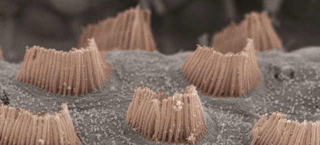 干细胞治疗将改变听力障碍的治疗方式