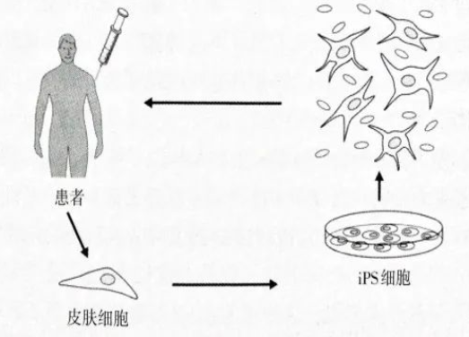 真正意义上的“返老还童之术”-iPS细胞技术的问世