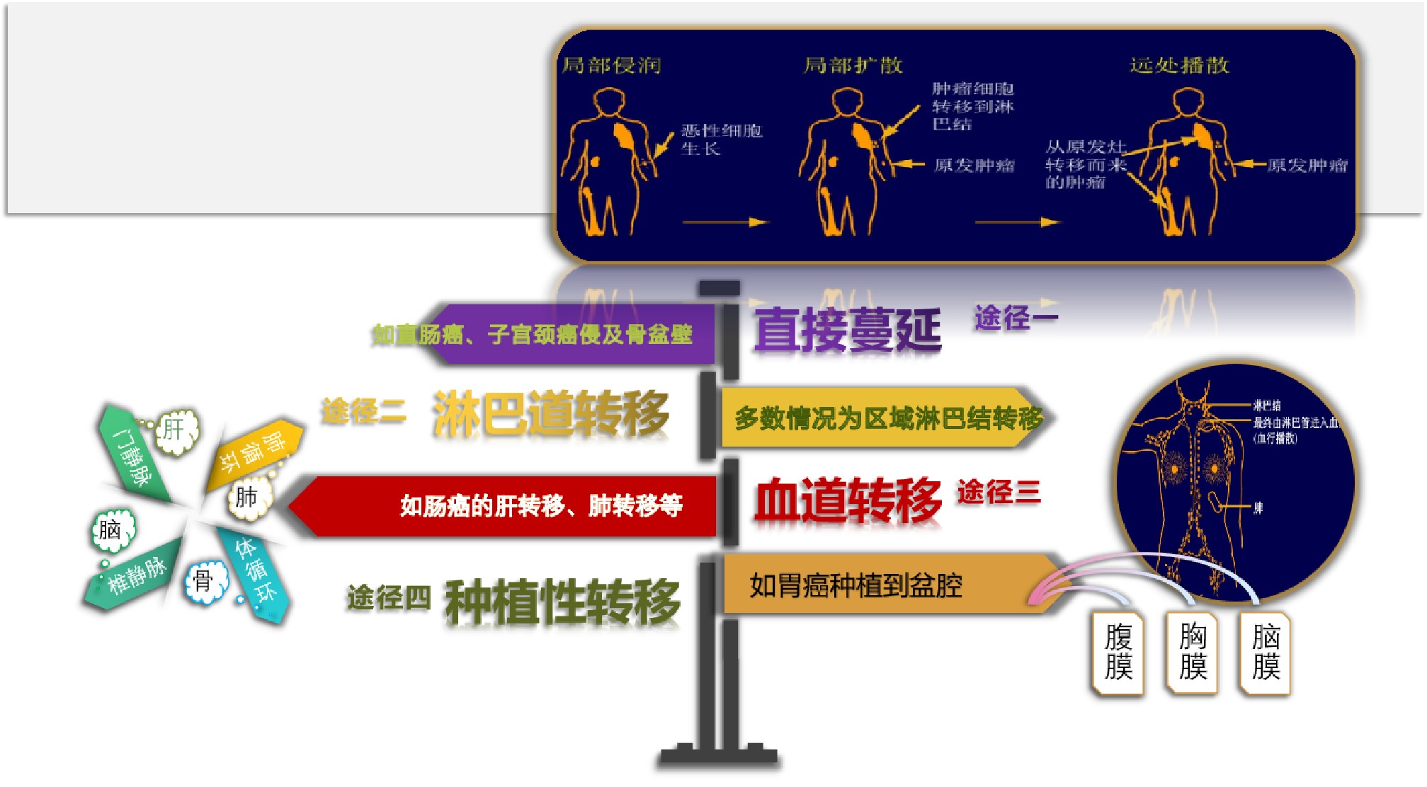 癌症的免疫细胞治疗