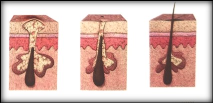 人类美丽4.0时代的核心载体-干细胞外泌体重新定义再生医学