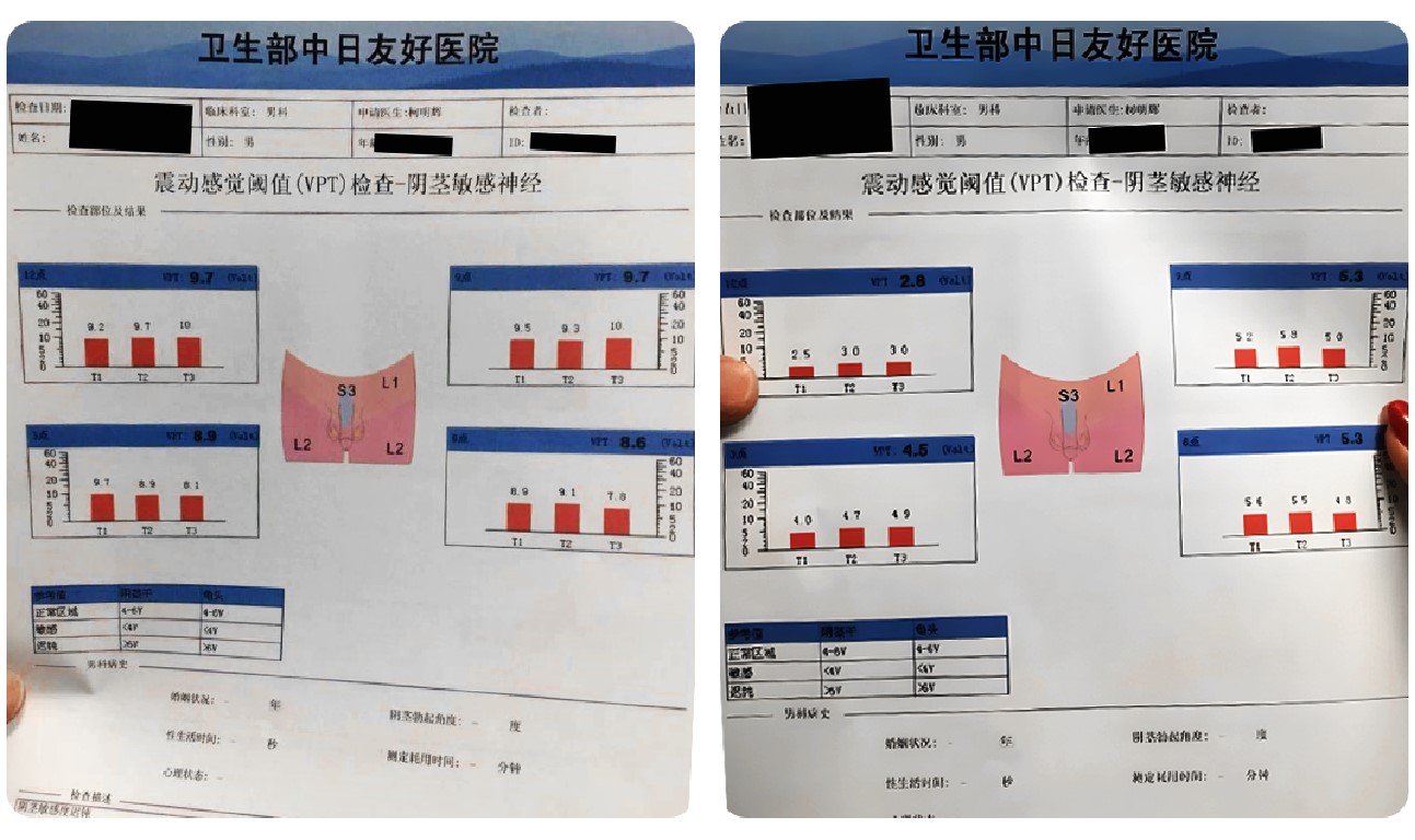 让男人更男人龙根生细胞微注射活化