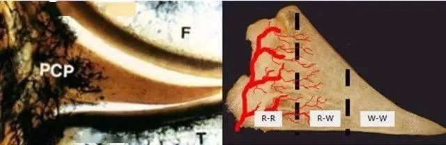 干细胞可提升半月板损伤修复和愈合速度