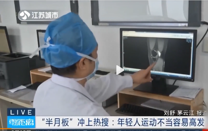 干细胞可提升半月板损伤修复和愈合速度