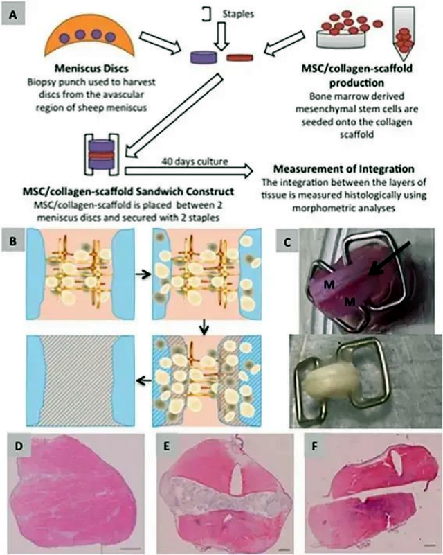 干细胞可提升半月板损伤修复和愈合速度