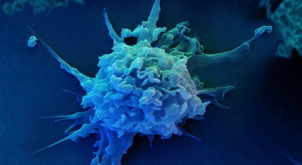 什么是肿瘤免疫？