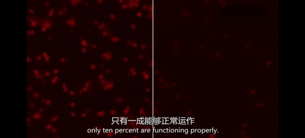 年轻人和老年人体内的免疫细胞对比有什么区别？