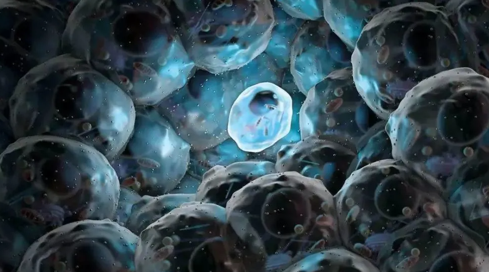 干细胞新资讯，糖尿病、恶性肿瘤有新突破