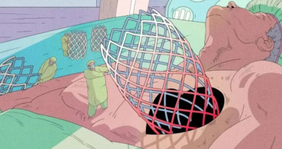 “心脏支架难救命”干细胞将成为心血管疾病的“强大补丁”