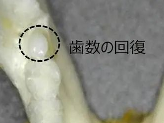 牙齿再生不是梦，世界首款牙齿再生药物临床试验，可促进牙齿第三次发育