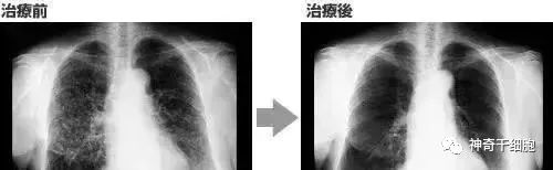 体内NK细胞的数量和活性是人体健康的重要保障