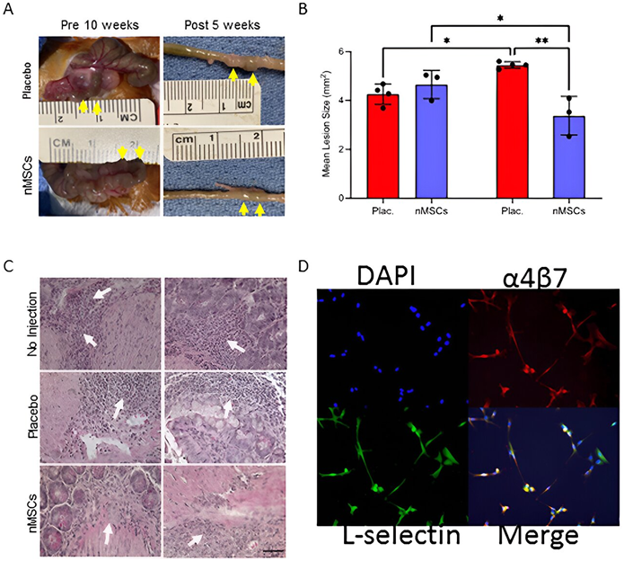 Advanced Therapeutics：来自新生儿心脏的间充质干细胞有望治疗克罗恩病