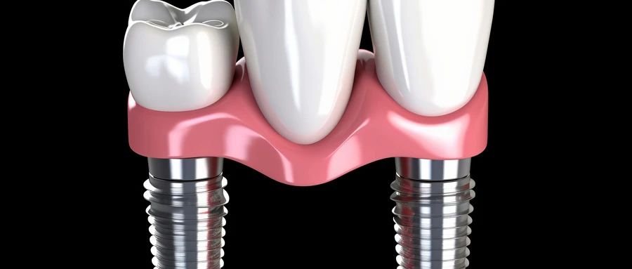 乳牙牙髓干细胞在口腔颌面疾病治疗中的应用