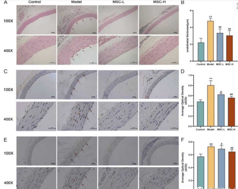 国际期刊：干细胞不仅可以降血糖，还能保护血管内皮，抵抗糖尿病并发症