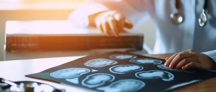 神经干细胞竞争“上岗” 两个基因是“幕后推手”