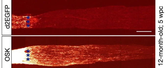 实验结果表面，干细胞治疗视神经损伤效果明显