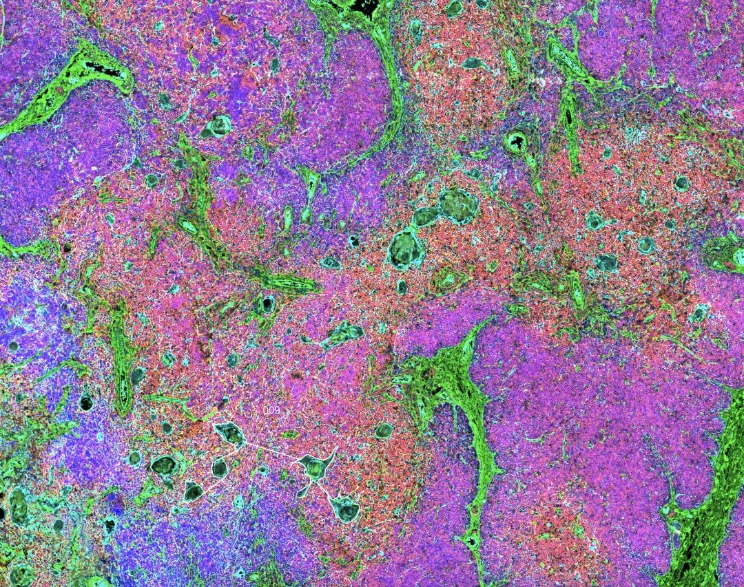 科学家首次在胸腺中发现干细胞，或有助改善免疫功能