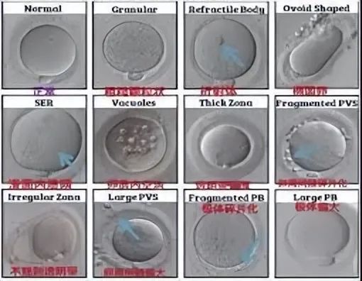 科学家拍到：人类卵子和精子结合那一刻，会爆发出一阵耀眼的光芒