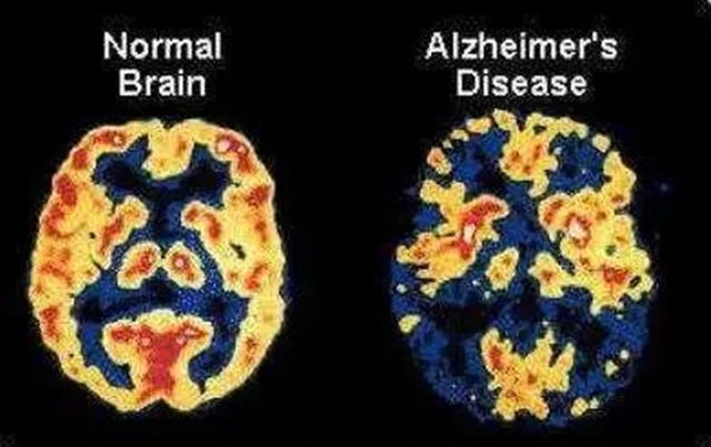 人类寿命能否达到150岁，干细胞是三大推动因素之一
