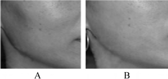 干细胞对女性健康有哪些重要的作用？