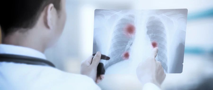 DC疫苗杀出重围，为癌症患者照亮生命之光！