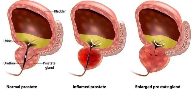 干细胞治疗有望减缓男性生殖系统衰老