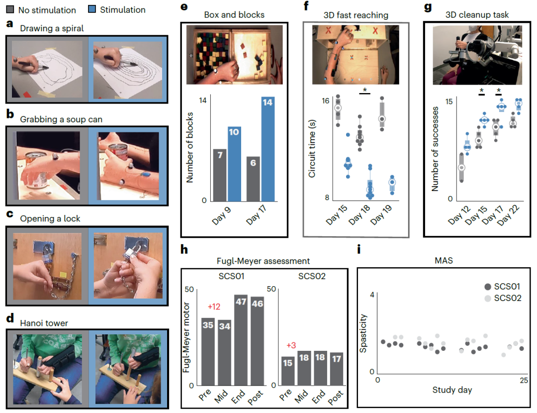 脊髓电刺激有助于脑卒中患者的上肢康复