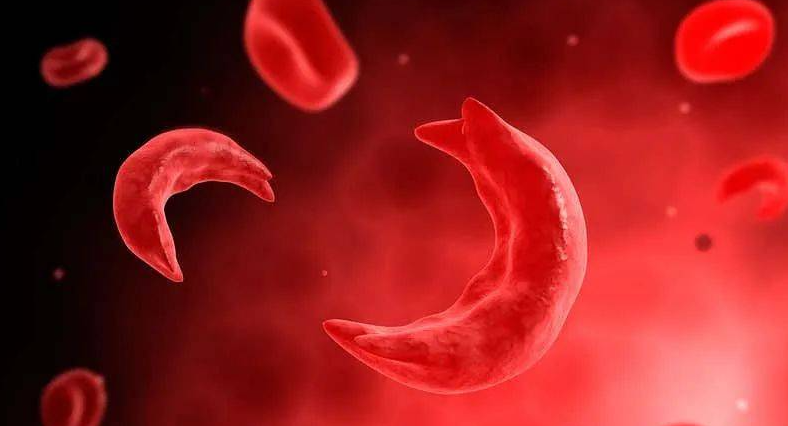 全球首款CRISPR/Cas9基因编辑药物在英国上市，可治疗地中海贫血