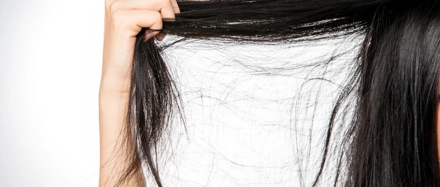 脱发与干细胞之间的关系，你知道多少？