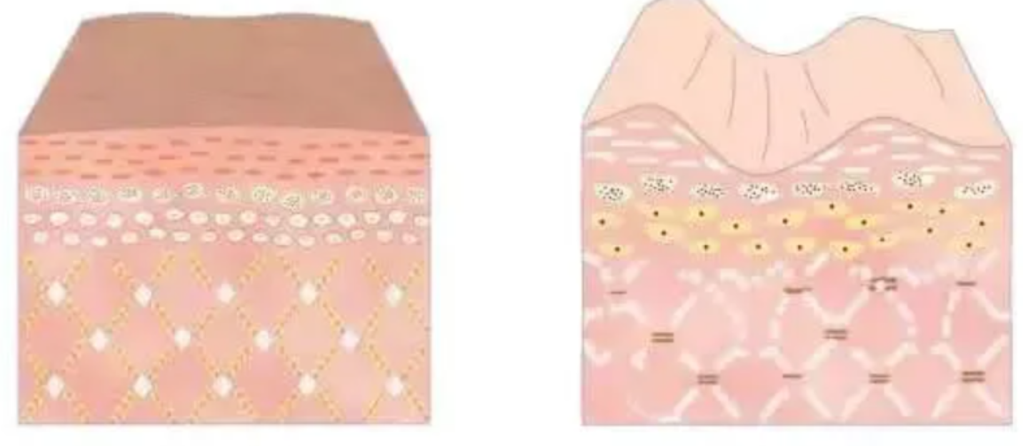 关于“外泌体”皮肤抗衰老，你知道多少？