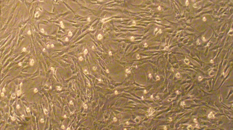 不同来源的间充质干细胞（MSC）之间的比较！