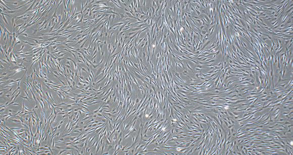 不同来源的间充质干细胞（MSC）之间的比较！