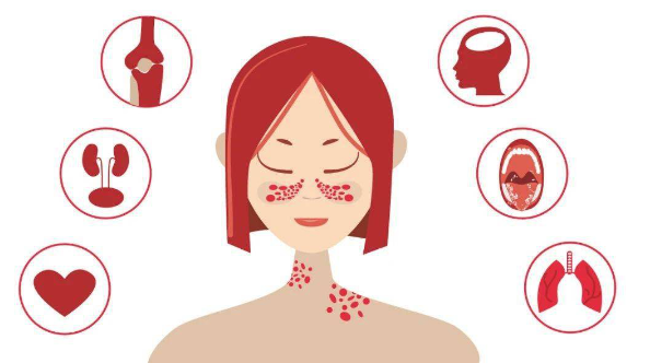 CAR-T细胞疗法治疗系统性红斑狼疮，让其不再是不可治愈的疾病！