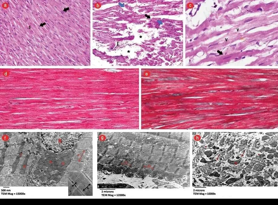 干细胞—心血管疾病的“强心剂”