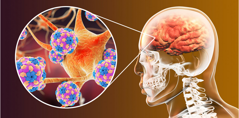神经干细胞(NSC)将成为神经退行性疾病治疗的有效方法