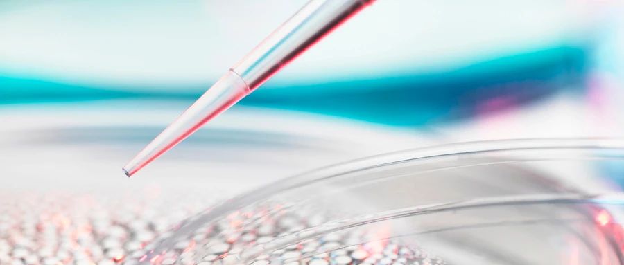 免疫细胞治疗痛风的相关案例