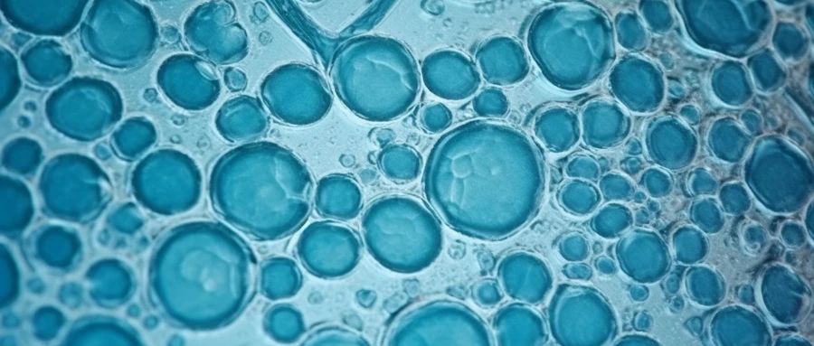 免疫细胞治疗痛风的相关案例