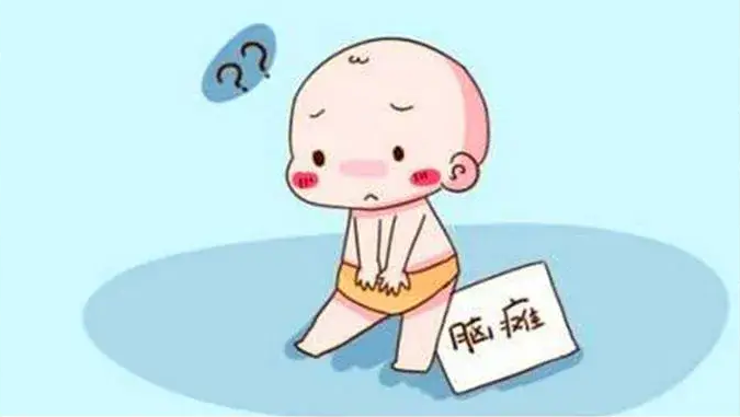 通过鼻腔内神经干细胞（NSC）移植治疗脑瘫的一项研究报告