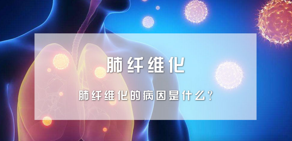 关于干细胞治疗肺纤维化的5个临床研究案例