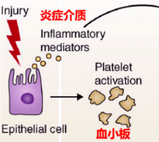 关于干细胞治疗肺纤维化的5个临床研究案例