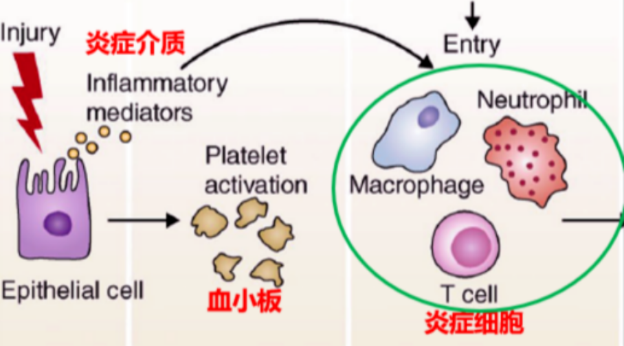 关于干细胞治疗肺纤维化的5个临床研究案例