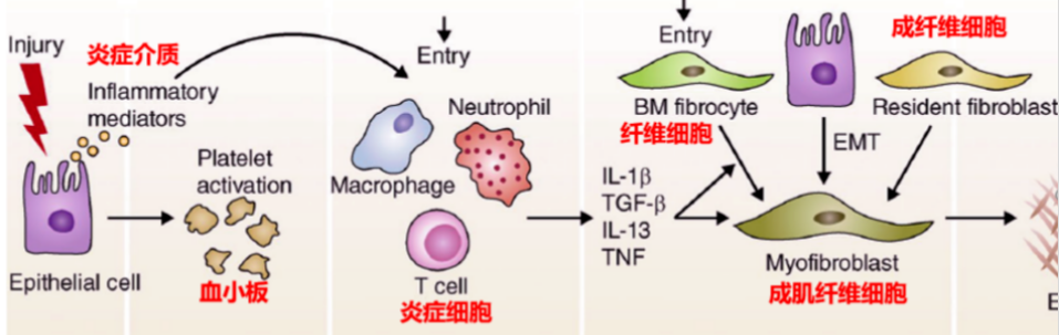 关于干细胞治疗肺纤维化的5个临床研究案例