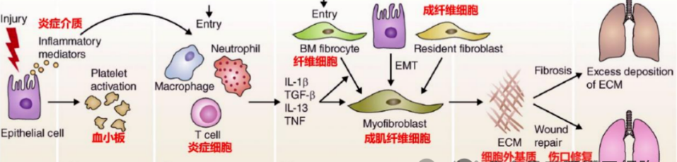 关于干细胞治疗肺纤维化的5个临床研究案例