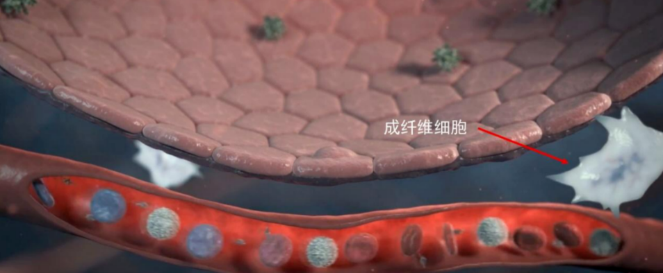 关于干细胞治疗肺纤维化的5个临床研究案例